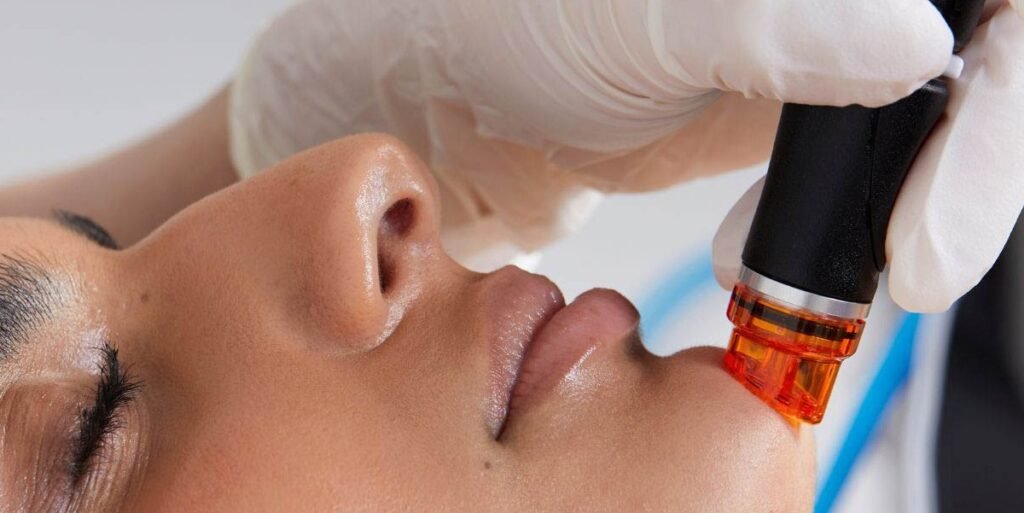 POP UP SITE INTERNET - 35